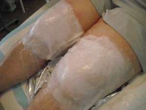 Pariffin Treatment on knees