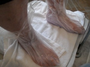 Paraffin Treatment on feet